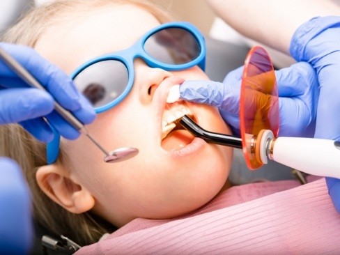 Child receiving dental sealants