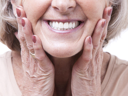 Closeup of woman smiling with dentures