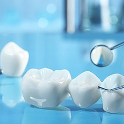 Dental bridge and dental implant materials against a blue background