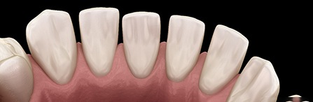 an illustration of gapped teeth