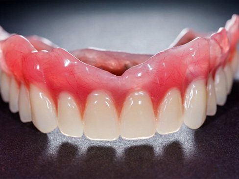 close-up image of an upper full denture