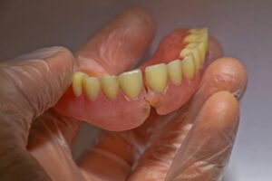 gloved hand holding broken dentures